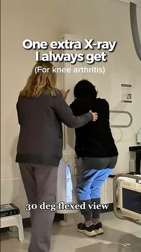AP vs Flexed Knee X-Ray: What Most Patients Don’t Know