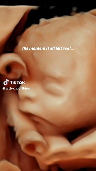 Capturing the Miracle of 4D Baby Scans