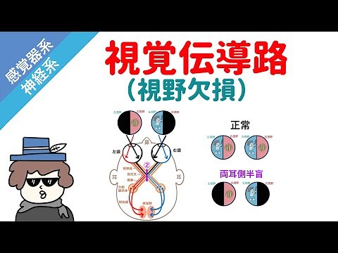 視覚伝導路と視野欠損の覚え方（PDF付き）