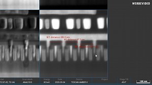 Extracting A Gate From AMD And Intel