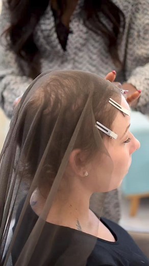 Mesh integration hair extensions are a great option for individuals experiencing hair loss. They provide full coverage over thinning or balding areas, blending seamlessly with natural hair for a natural look. Customizable to match hair color and texture, they offer comfort, versatility, and are non-damaging, providing a long-term solution for managing hair loss with confidence. #stylebyevehair #meshintegration #stylebyeve #HairTransformation #hairstyle #hairlosstransformation | Stylebyeve