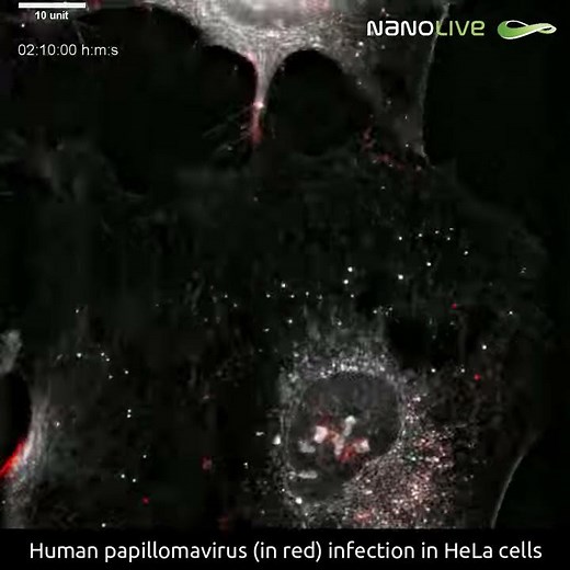 Human paillomavirus infection in HeLa cells