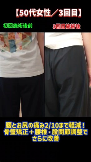 【50代女性／3回目】腰とお尻の痛み2/10まで軽減！骨盤矯正＋腰椎・股関節調整でさらに改善