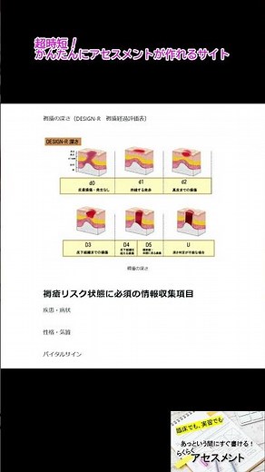 【看護学生向け】 あっと言う間にすぐ書ける！褥瘡リスク状態のアセスメント #看護学生 #看護師国家試験 #看護クイズ