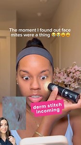 🧬 We all have them on our skin! They’re called Demodex mites — tiny, microscopic creatures living in your hair follicles and oil glands, mostly on your face. Creepy? Maybe. Harmful? Usually not. They help clean up dead skin cells and oil. But when they overgrow, they can cause: ✅ Rosacea flares ✅ Itchy, irritated skin ✅ Crusty eyelids (blepharitis) ✅ Redness or flaky patches Treatments like medicated creams, sulfur washes, or ivermectin can bring them under control without harming your skin bar