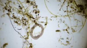 Amazing World Microbiology Different Bacteria Microbes Stock Footage Video (100% Royalty-free) 3720585409 | Shutterstock