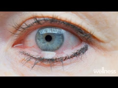 What is evaporative dry eye and how to treat it