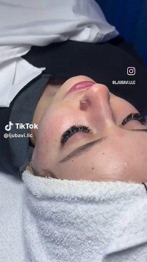 Vacuum Suction Facial🫶🏼 What is it? It is a mechanical machine-based treatment using a small ventouse, a glass tube, that creates a vacuum feel on the skin’s surface Benefits✨ Improves lymphatic circulation which has a detoxing effect, improves lymphatic flow helping to reduce puffiness, helps brighten the skin by exfoliating dead skin cells, stimulates the microcirculation of the skin which brings blood to the epidermal layers therefore nourishing skin cells and contributing to faster skin ce