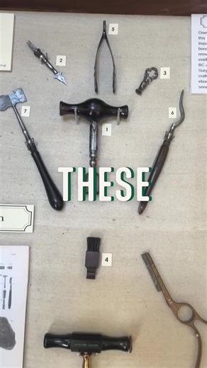 This is ancient brain surgery tool is still used today | Old Photos