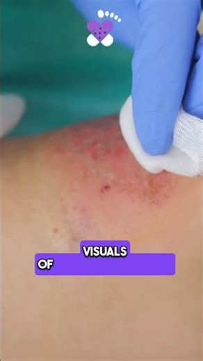 Healing Chronic Wounds Effectively | Faster Recovery Tips 🩹