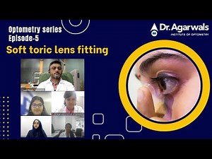 Optometry Series Episode-5 Soft toric lens Fitting