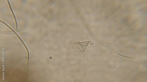 Bacteria Parasites and Worms in drinking Water under Microscope. nematode Worm under Microscope, Parasites Among Roundworms: Roundworms, Pinworms, Trichinella. Environmental Pollution.