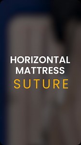 淋 Master the Horizontal Mattress Suture Technique! Join Dr. Uday...
