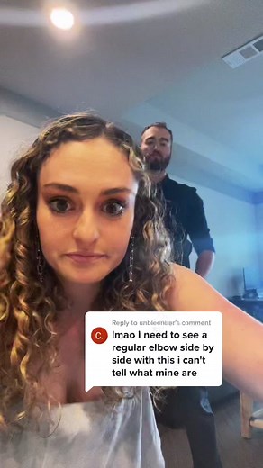 Reply to @unbleentier I will try to convince him to do the whole beighton score and we can compare #hypermobility #hEDS #hypermobile