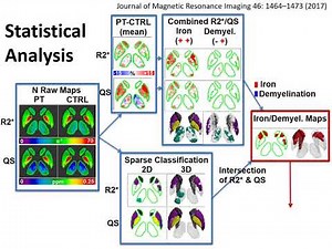 Ahmed Elkady - Progressive iron accumulation of MS phenotypes via sparse classification of DGM