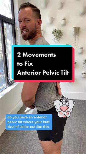 Effective Movements for Anterior Pelvic Tilt and SI Joint Pain Relief