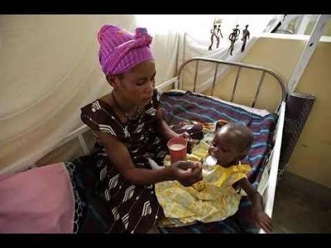 Monitoring Feeding in Sick Children; because illness can alter appetite, nutrient absorption