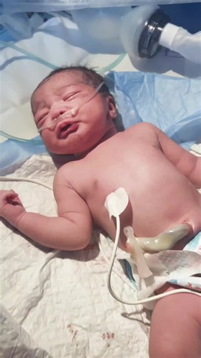 Capturing the Joy of a Newborn's First Breath