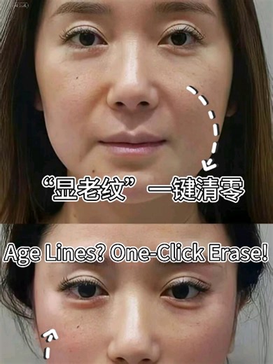 #无针水光 #高压渗透技术 #纳米微晶导入 #无创水光仪 #透皮补水 #NeedleFreeHydrafacial #ElectroporationTech #NanoInfusion #PainlessHydration #PressurizedSerumBoost #水光肌自由 #手残党福音 #贵妇体验平民价 #急救翻盘时刻 #零恢复期 #DewySkinDream #NoSkillGlow #LuxuryForLess #SkinEmergencyFix #countdowntozero