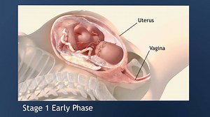 Moms really “work” during the 3 stages of labor: early labor, active labor, and delivery. Watch this video to learn more about labor and childbirth. | Eunice Kennedy Shriver National Institute of Child Health and Human Development