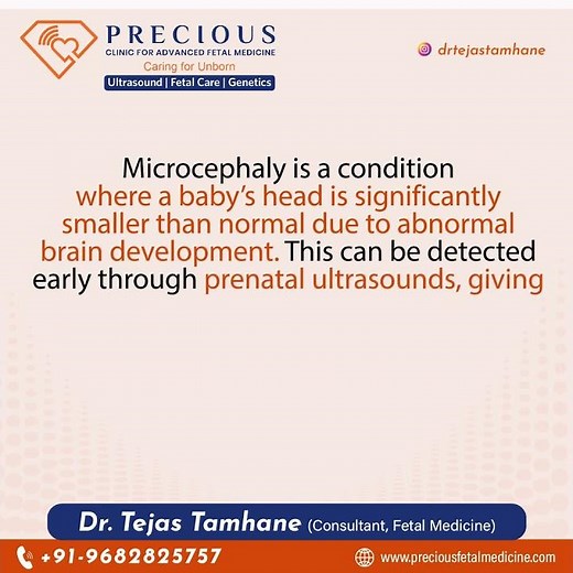 Learn about microcephaly and how it can impact development.