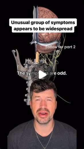 Dr. Nathan Berner on Instagram: "In our office, we were seeing an odd group of symptoms that often come together. Over the last few years we are seeing more and more cases that present with the combination of dizziness or vertigo, brain fog, fatigue, ringing, or fullness in your ears, and unusual digestive issues, if this sounds like you tell us your story below #digestivehealth #guthealing #gutfriendly #vagusnerve"