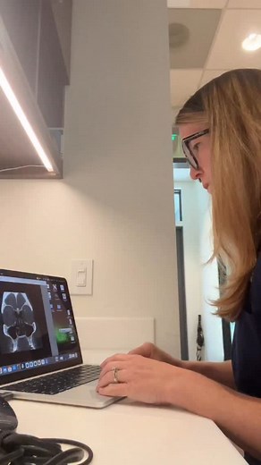 You deserve better 💫 Many people who think they have “chronic sinus infections” may not actually have infections at all. 🤯 This study (PMID 40635197) shows that what gets labeled as a sinus problem is often something else-like allergies, reflux, structural issues, or even migraine. That’s why a proper ENT evaluation is so important if you have ongoing sinus headaches, nasal congestion, pressure, post-nasal drip, or brain fog. If you’ve been told you have a “history of sinus problems,” don’t ju