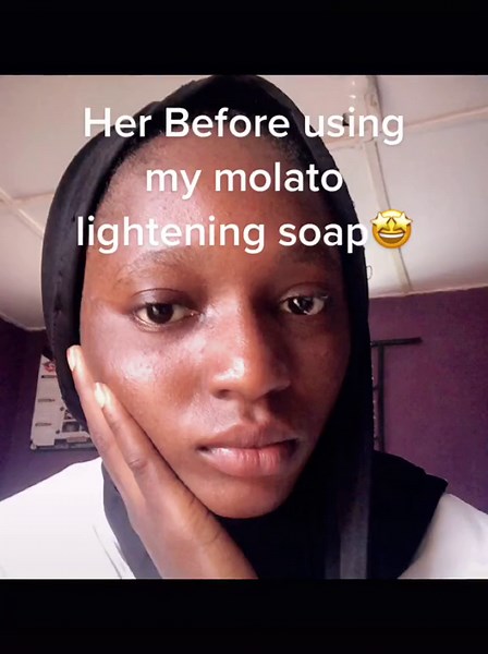 Understanding the Side Effects of Molato Soap: Reviews & Before/After Pictures