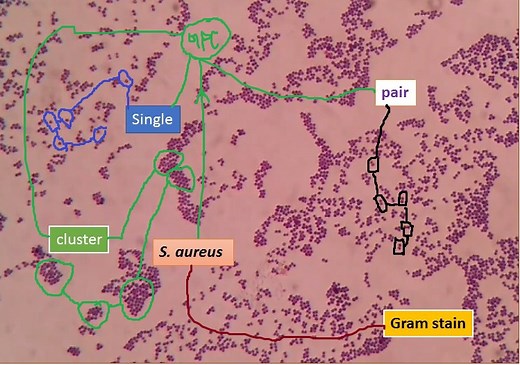 Staphylococcus aureus Gram stain: Introduction, Principle, Procedure