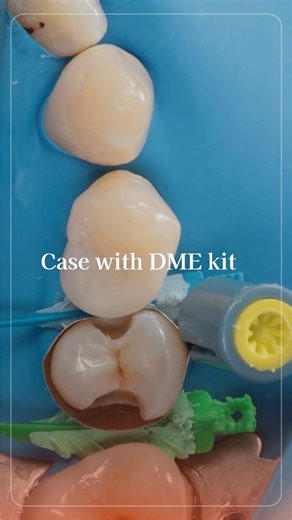 Garrison Dental Solutions on Instagram: "Deep margin elevation and proximal rewalling were performed using the Garrison’s DME Reel and ReelMatrix system, re-establishing a clean, supragingival adhesive field before biomimetic buildup. Sectional Matrix System used: Garrison’s Strata-G Case by @drjoshualee #garrison #restorativedentistry #garrisondental #dentalproducts"