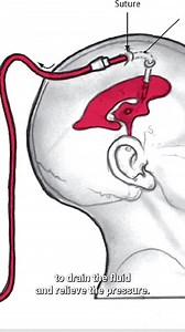 1.3K views | The Surgery That Changed Everything For Doctors  Part 4 | Behind Closed Doors | Facebook