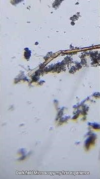 Darkfield Microscopy/ Microorganism under Microscope #microscopevideo #microscope #science #nature