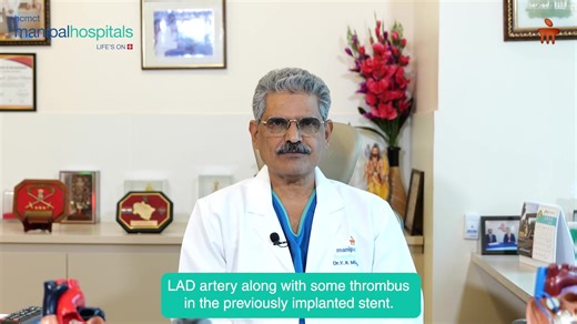 After facing complications from his previous heart surgery, Mr. Aggarwal, a 70-year-old patient, found renewed hope at Manipal Hospital, Dwarka, under the expert care of Dr. Yugal Kishore Mishra, Chief of Clinical Services, Chairman - Manipal Institute of Cardiac Sciences & Chief Cardiovascular Surgeon. Dr. Mishra and his team performed a robotic-assisted Coronary Artery Bypass Grafting (CABG), utilizing the advanced Surgical Robotic System for telerobotic precision. This minimally invasive proc