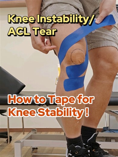 Knee Taping and ACL Injury Prevention