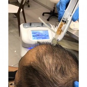 4.3K views · 44 reactions | Hycoox Multi Suction Injector is an...