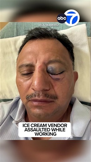A #LongBeach #icecreamvendor is recovering from serious injuries after he says he was assaulted while working near Belmont Veterans Memorial Pier on the 4th of July, leaving him unable to work and support his family during his recovery.