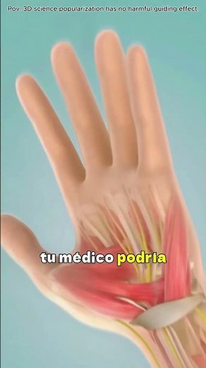 Carpal Tunnel Release Surgery (3DAnimation)#carpal#carpaltunnel#carpaltunnelpain#carpaltunnelrelief