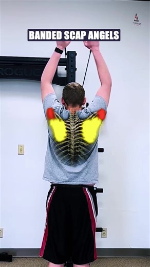 🔥 2 Things You're Neglecting That Kill Shoulder Mobility 🔥 Stretching more isn’t the answer. If your overhead mobility sucks, it’s probably because of these two overlooked pieces: ❌ The Real Problem: No Posterior Tilt – Everyone squeezes their shoulder blades back (retraction), but few know how to tilt the scapula down and in. Without posterior tilt, the shoulder gets stuck in a dumped-forward position. Stiff Thoracic Spine – A locked-up upper back stops the scapula from upwardly rotating. No 
