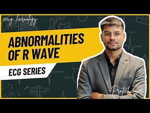 Abnormalities of the R Wave on ECG | Poor R Wave Progression, Tall R & R Wave Loss Explained