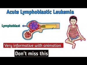 Acute Lymphoblastic Leukemia(ALL) | clinical presentation of ALL |diagnosis of ALL| Treatment of ALL