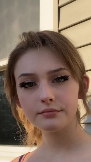 Improvement in My Bell’s Palsy Recovery