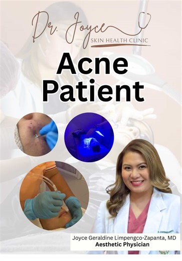 Clear skin doesn’t happen overnight. There were doubts, breakouts, and days of waiting. This is her acne journey— real progress through proper care and consistency. ✨ We’re proud to be part of her journey and grateful for the trust she gave us. 🤍 📩 Message us to start your acne journey. 📍La Carmelita Compound, Brgy. Patimbao Sta. Cruz, Laguna 📲 DM us or call 09676001249 📧 dr.joyceclinic2022@gmail.com #DrJoyceSkinClinic #acne #AcneProneSkin #AcneTreatment #fyp