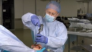 Persona® Revision Trabecular Metal® Cones Metaphyseal Fixation Insights