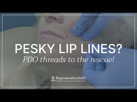 From Lips to Knees: PDO Threads Do It All