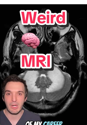 Don’t chase the 🐉 #brain #neuroscience #doctor #radiology #medicine | Neuroscience