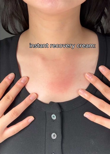 Orien Moisturizer: Ultimate Solution for Acne and Rosacea