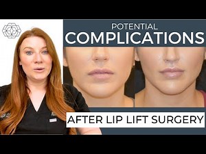 Potential Lip Lift Complications