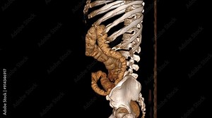 Realistic 3D CT Scan of Male Torso Bones: Detailed Anatomical Reconstruction for Medical Animation