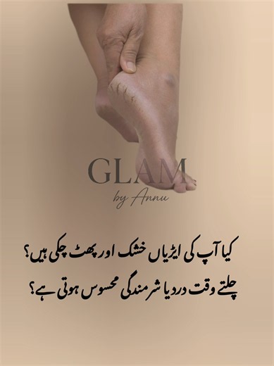 Effective Home Remedies for Dry and Cracked Heels