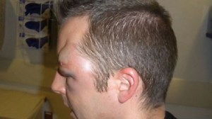 Police say attacks on officers are on the rise